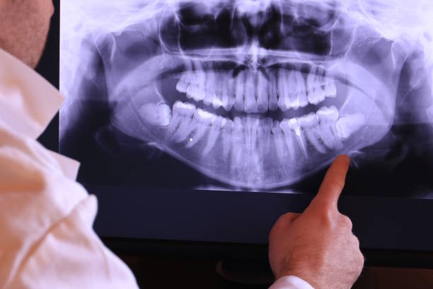 Best Urgent Care for Lost Fillings or Crowns in Tompkinsville, KY