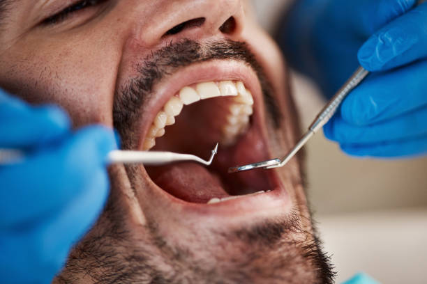 Best Emergency Treatment for Dental Infections or Abscesses in Tompkinsville, KY