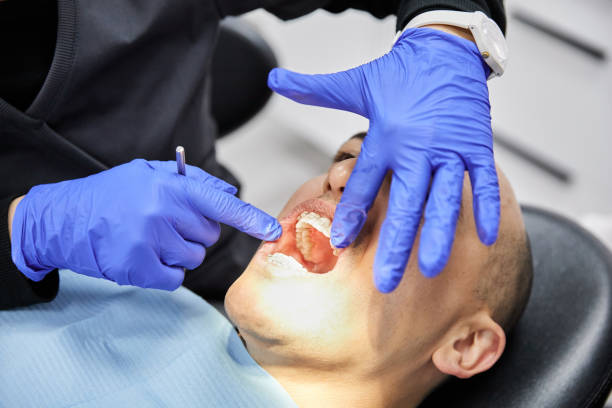 Best Emergency Dental Care for Broken or Chipped Teeth in Tompkinsville, KY